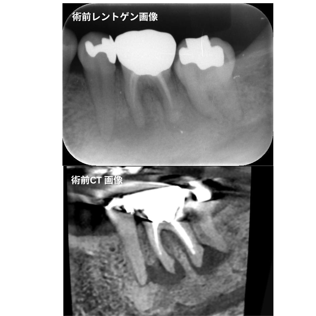 セカンドオピニオン症例