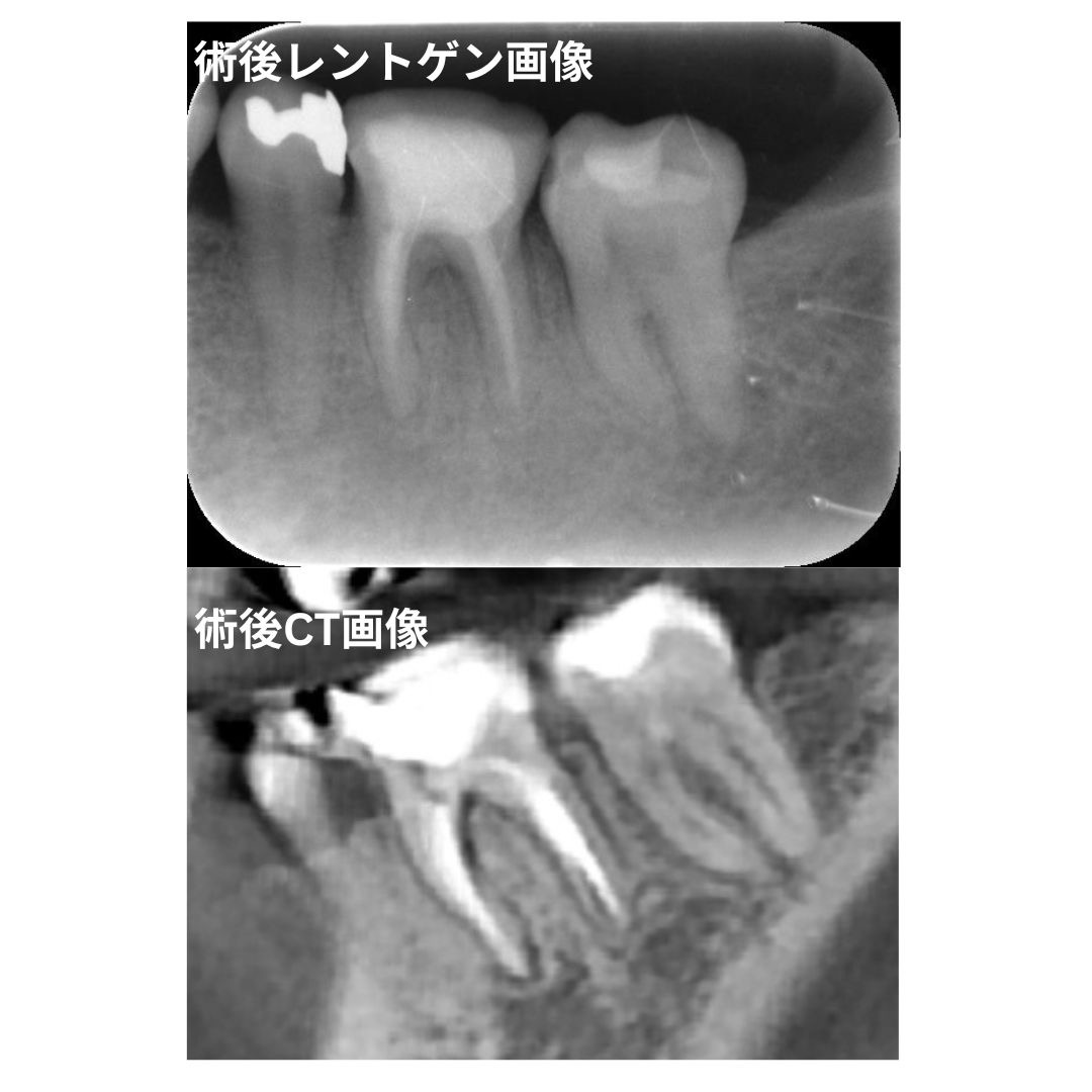 セカンドオピニオン症例